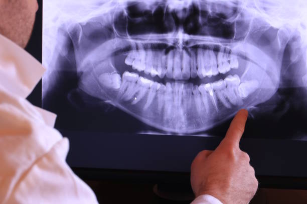 Best Emergency Root Canal Treatment in Austin, AR