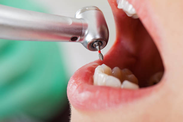 Best Same-Day Emergency Dentist in Austin, AR